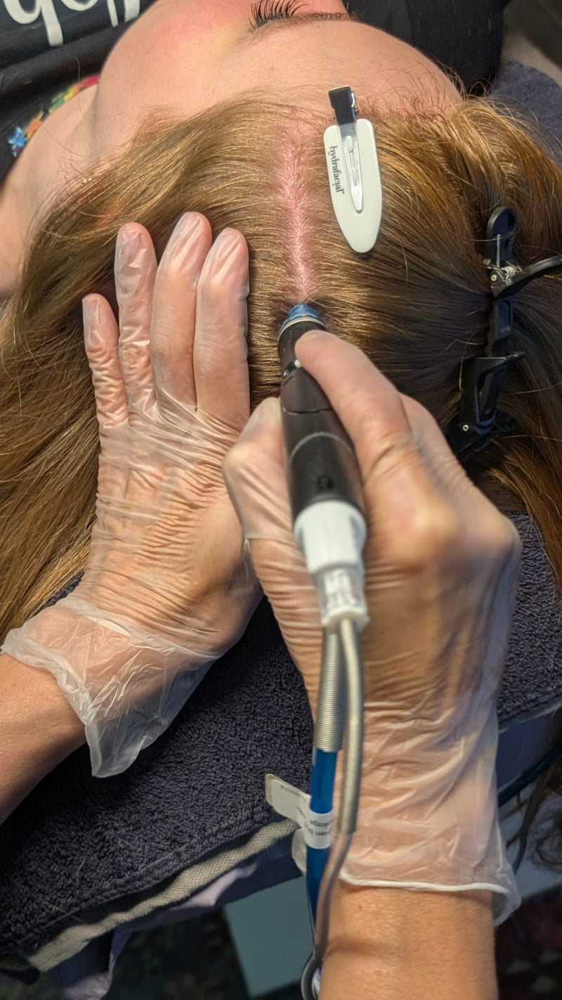 The Mismo HydraScalp Hair Wellness Series