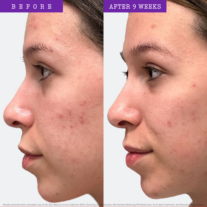 Recovery Spot Treatment