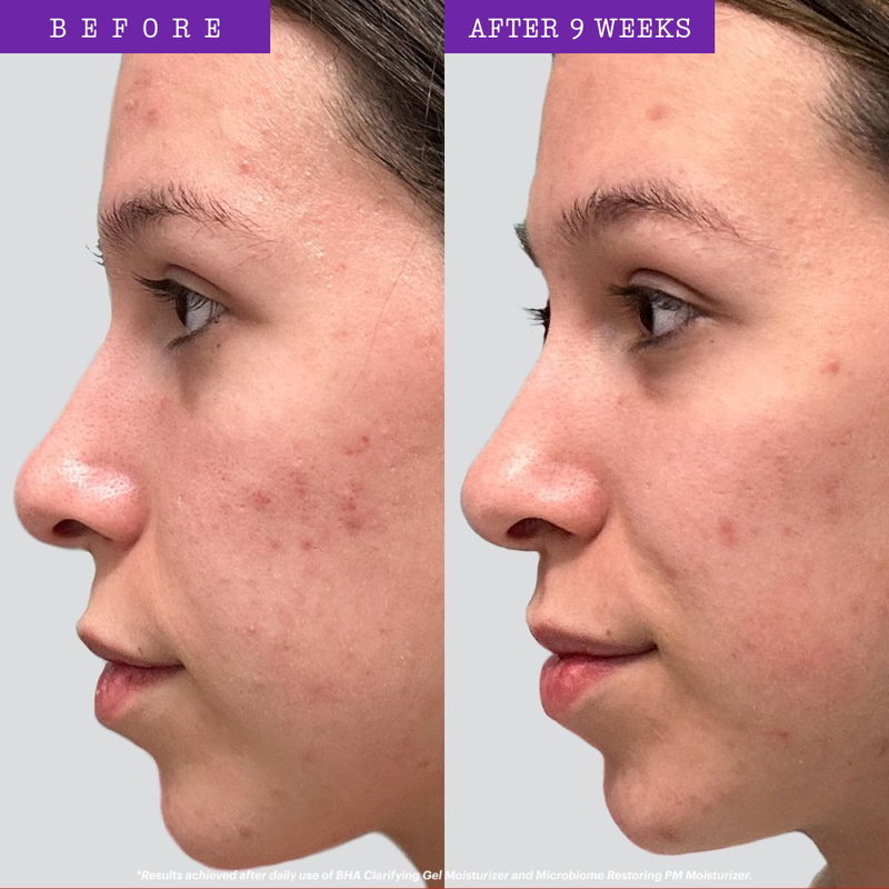 BHA Clarifying Gel Moisturizer