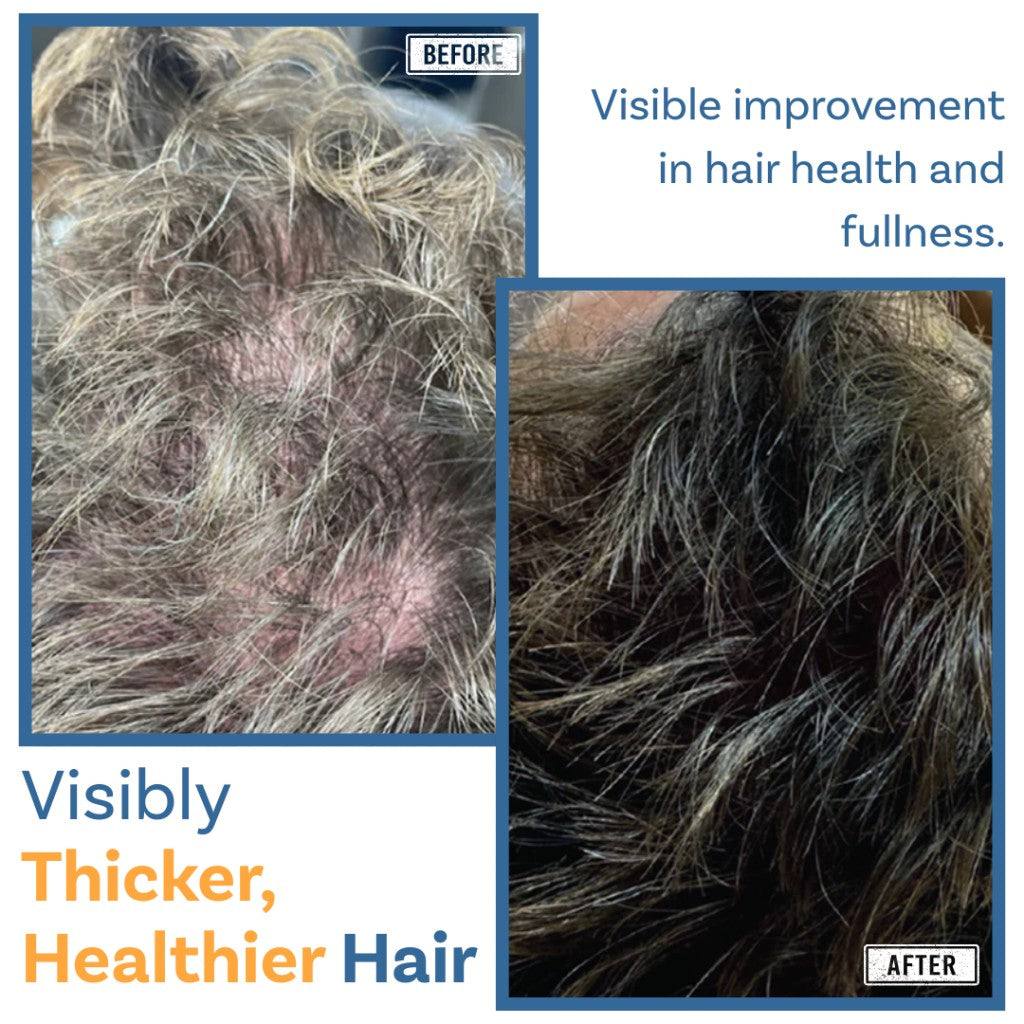 Visibly thicker, healthier hair — visible improvement in hair health and fullness