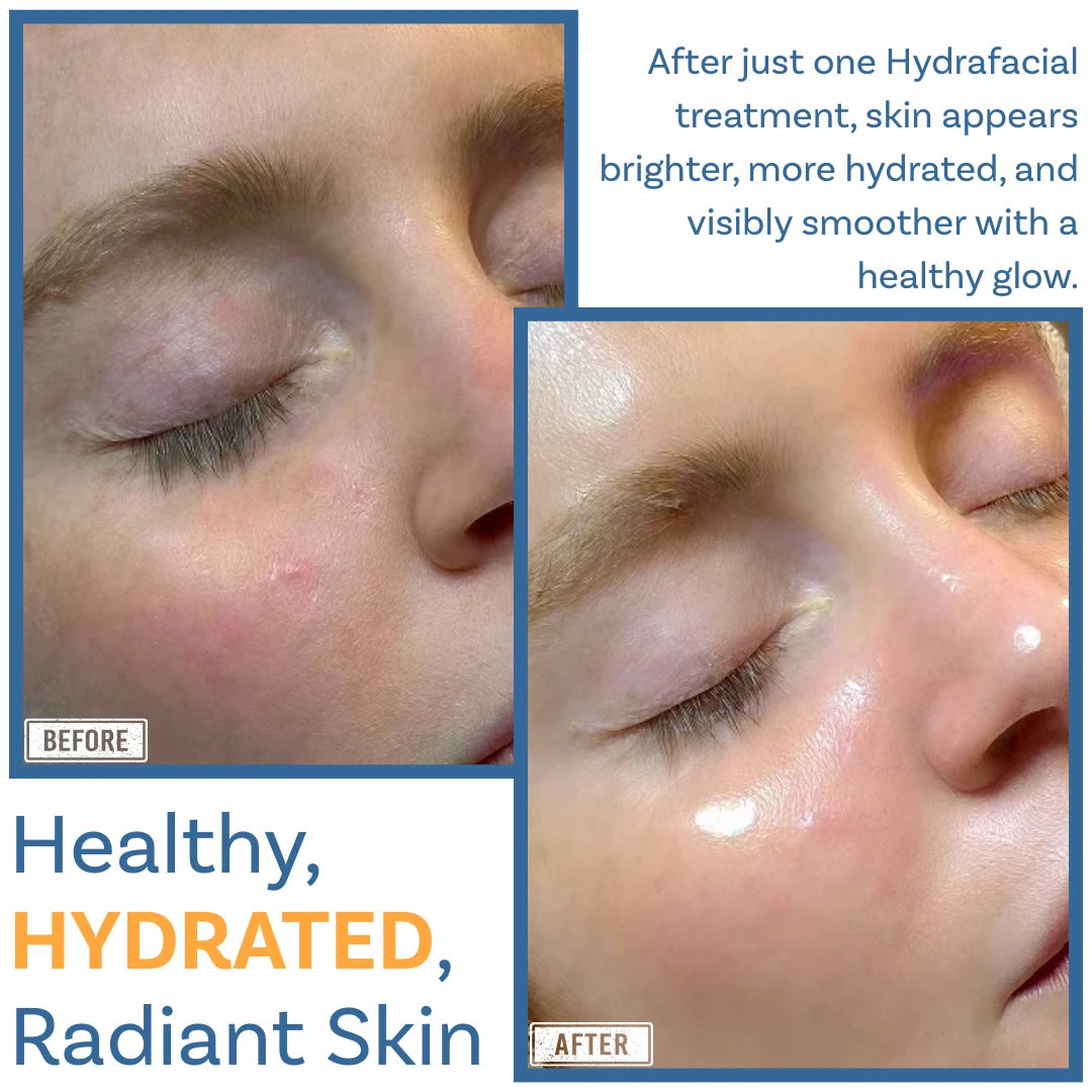 Healthy, Hydrated, Radiant Skin