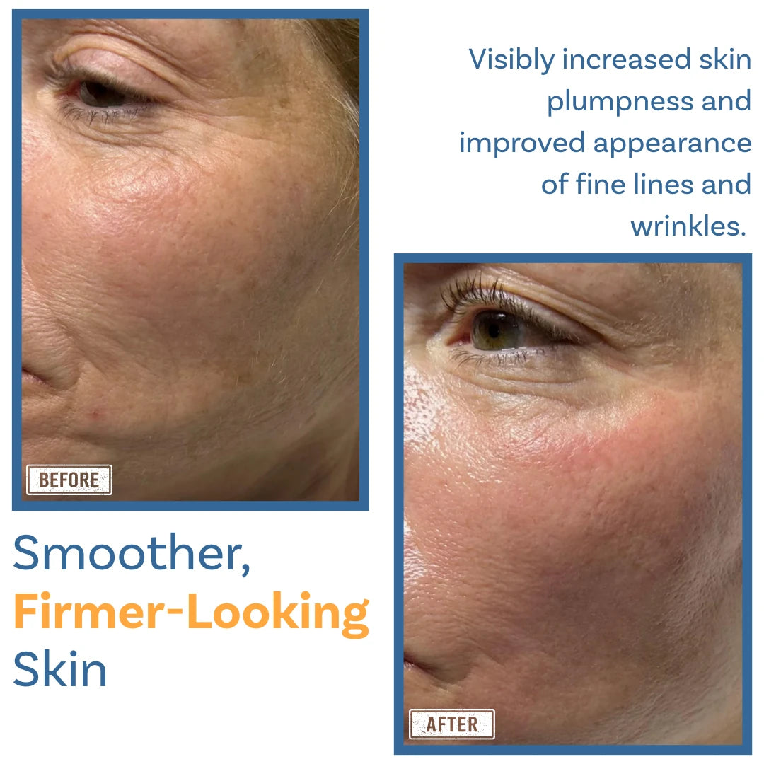 Smoother, Firmer-Looking Skin