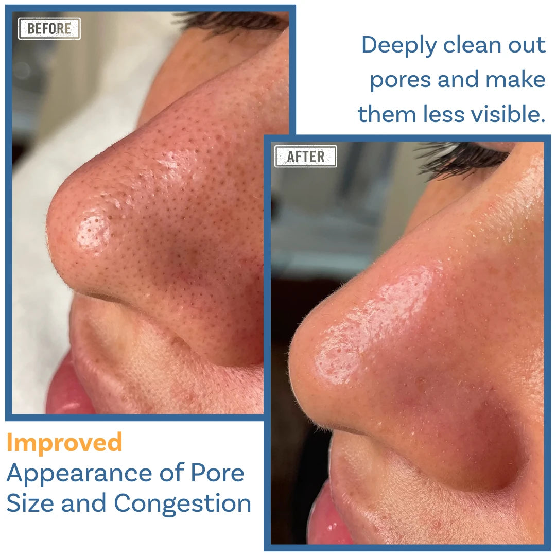 What thoughtful care can do