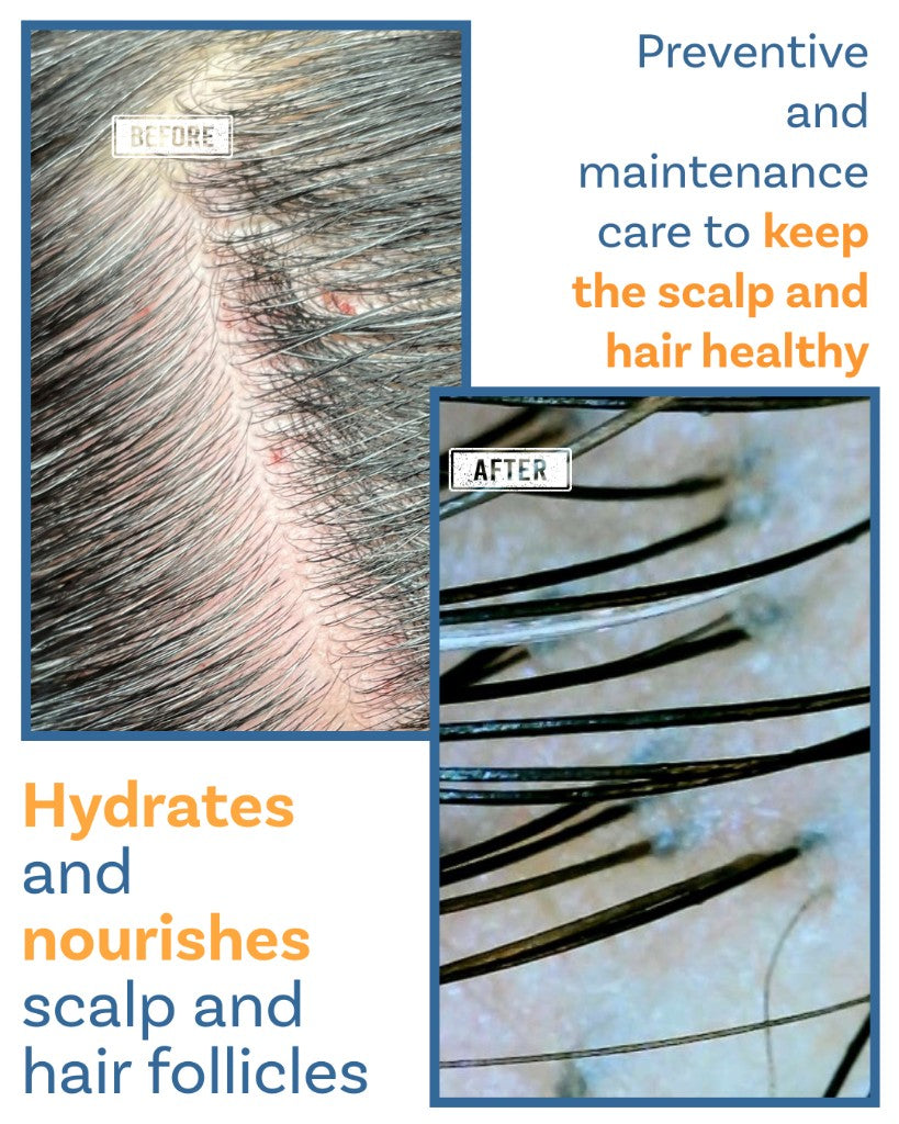 Keravive Scalp Treatment - Before and After Results