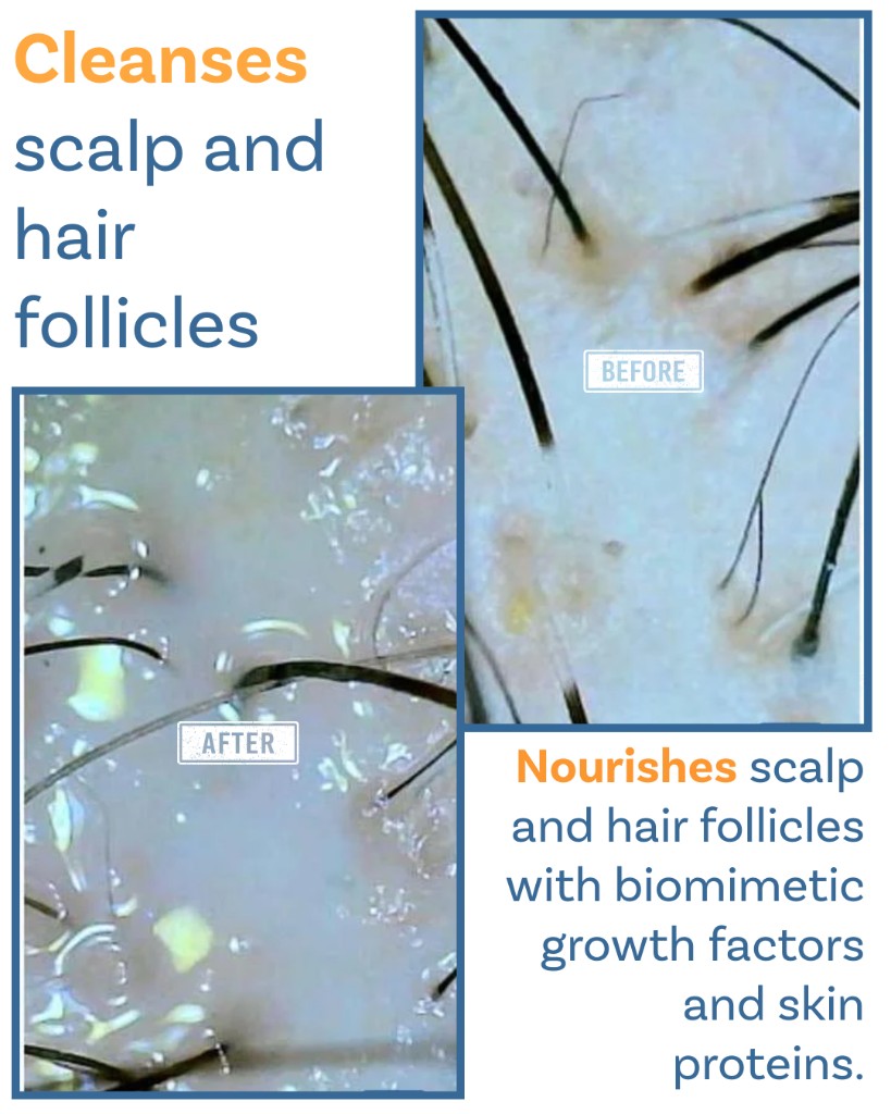 Keravive Supports keratin production and scalp microcirculation - Before and After