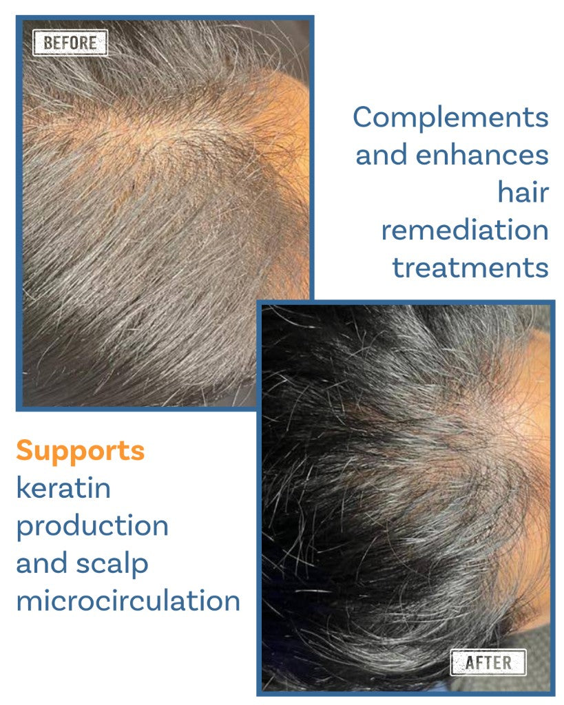 Keravive Hydrates and nourishes - Preventive care Before and After