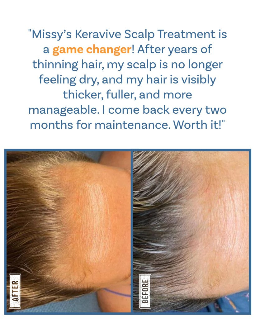 Keravive Exfoliates build-up, Hydrates scalp - Before and After