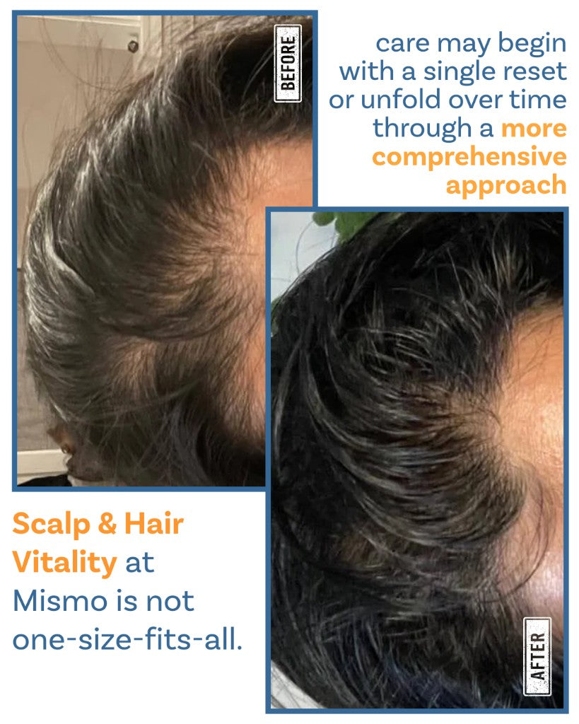 Scalp & Hair Vitality at Mismo - Comprehensive approach Before and After