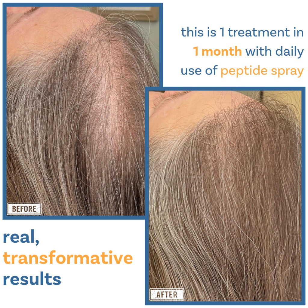 Scalp & Hair Vitality Results - Before and After 2