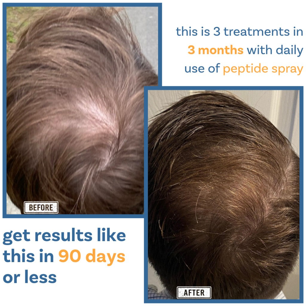 Scalp & Hair Vitality Results - Before and After 3